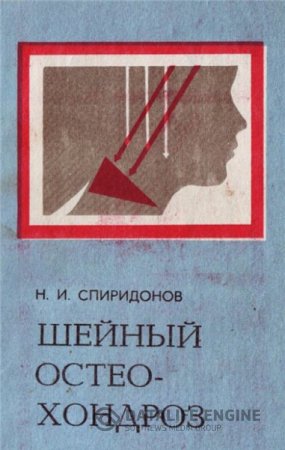 Н.И. Спиридонов. Шейный остеохондроз (1983) DjVu